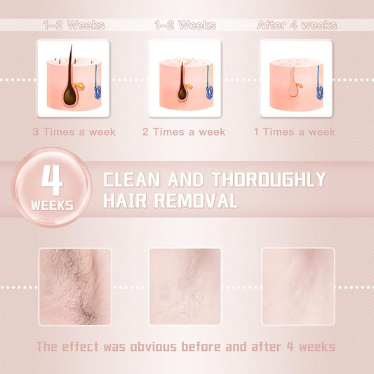 IPL Laser Hair Removal Device for Women and Men